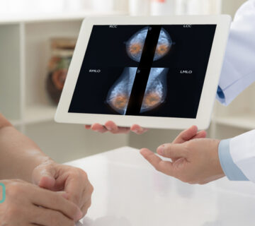 چرا باید ماموگرافی انجام داد؟ (چه کسانی باید ماموگرافی انجام دهند؟) - 8