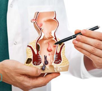 علائم سرطان مقعد چیست؟ تشخیص و درمان - 3