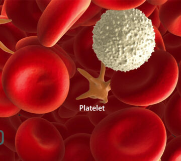 پایین بودن پلاکت خون: نشانه سرطان است؟ علائم، علت‌ها و روش‌های درمان - 2