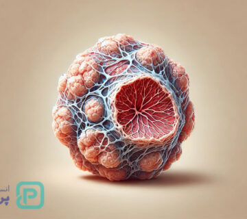 تومور چیست؟ علائم، تشخیص و درمان انواع تومور - 15