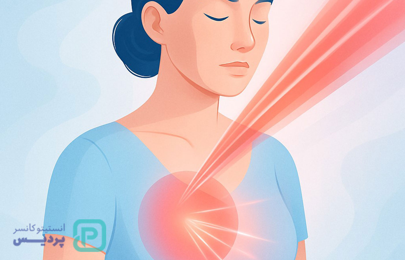 عوارض پرتو درمانی سینه؛ آشنایی با اثرات کوتاه‌مدت و بلندمدت این روش درمانی - 1