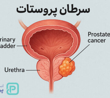 دلایل ابتلا به بیماری‌های پروستات | هر آنچه باید درباره پروستات، علائم و راه‌های پیشگیری بدانید - 20