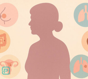 شایع‌ترین سرطان‌ها در خانم‌های بالای 50 سال | آمار، علائم و پیشگیری - 25