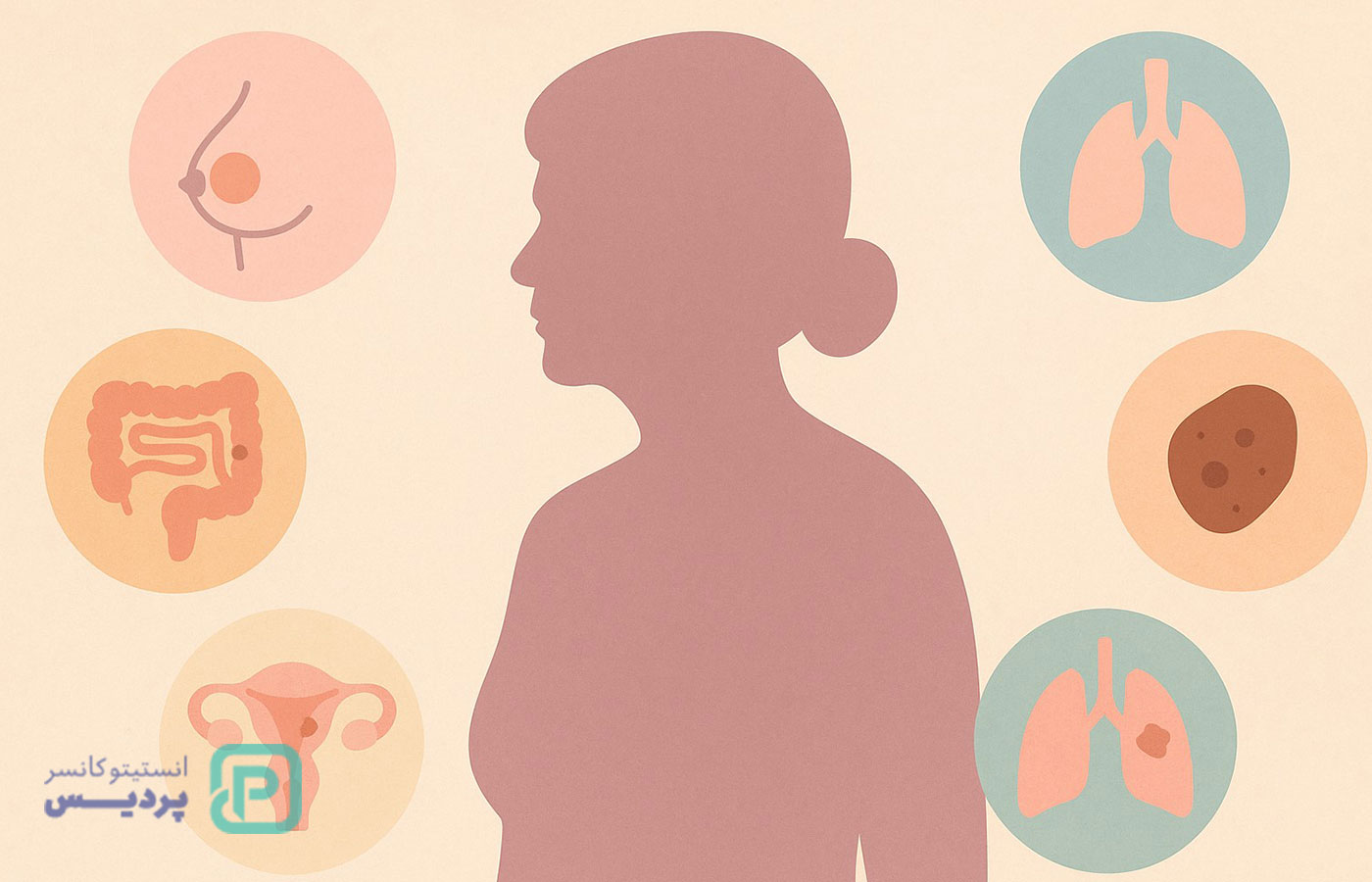 شایعترین سرطانها در خانمهای بالای 50 سال | آمار، علائم و پیشگیری 1 Image 682af73f35585