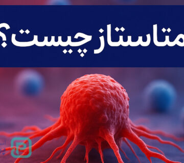 متاستاز چیست؟ همه چیز درباره گسترش سرطان به زبان ساده - 9