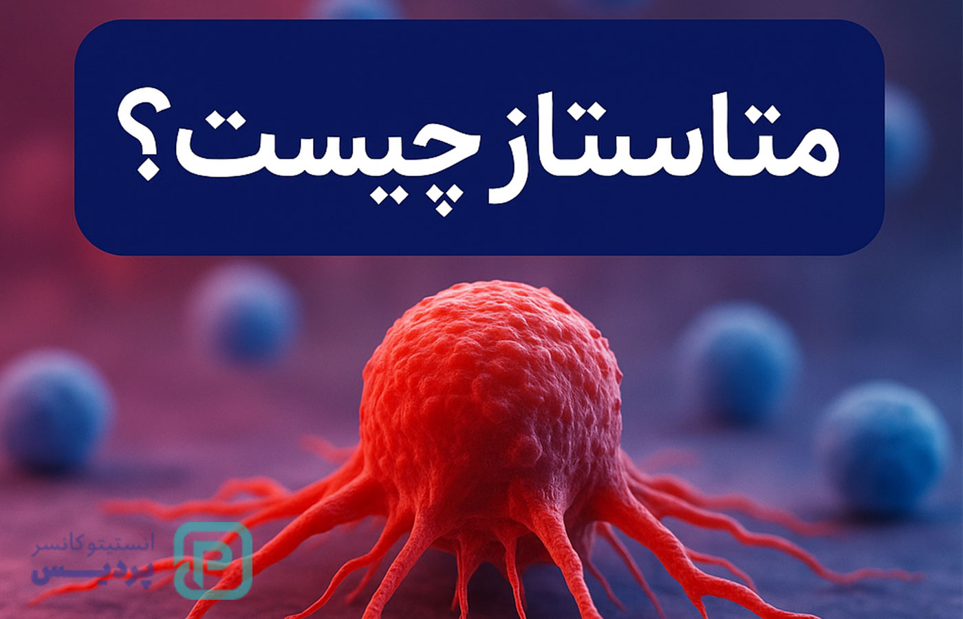 متاستاز چیست؟ همه چیز درباره گسترش سرطان به زبان ساده - 1