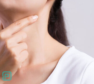 سرطان غده لنفاوی چیست؟ | علائم، انواع و روش‌های درمان لنفوم - 10