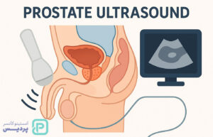 سونوگرافی پروستات چیست و چرا انجام می‌شود؟ - 6