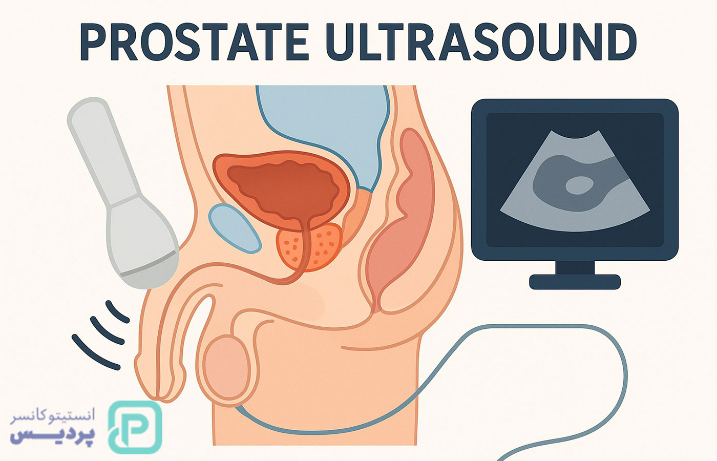 سونوگرافی پروستات چیست و چرا انجام میشود؟ 1 سونوگرافی پروستات چیست و چرا انجام میشود؟ - 1