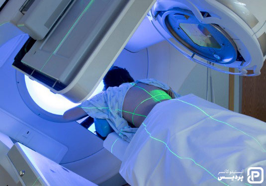 IMRT چیست و چگونه به درمان سرطان کمک می کند 2 آمادگی های لازم برای IMRT