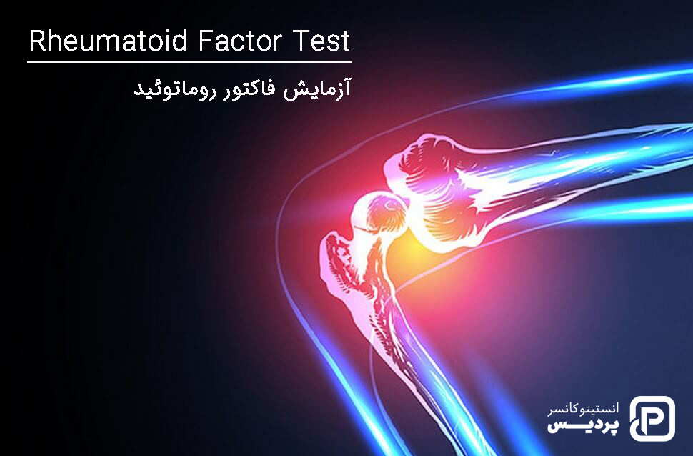 آزمایش خون برای تشخیص سرطان