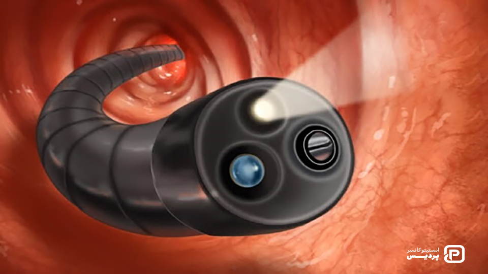 انواع آندوسکوپی