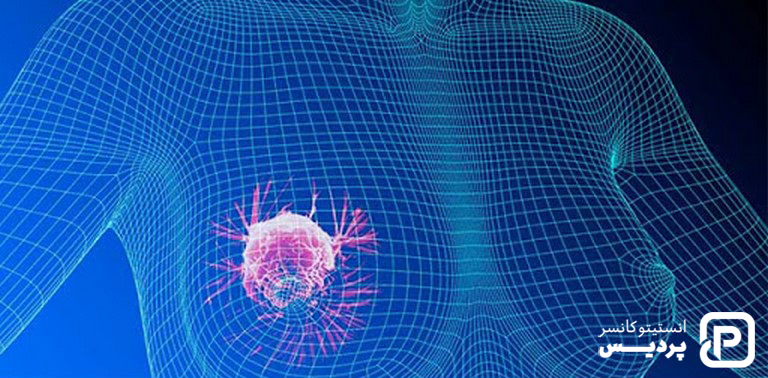 انواع نادر سرطان پستان