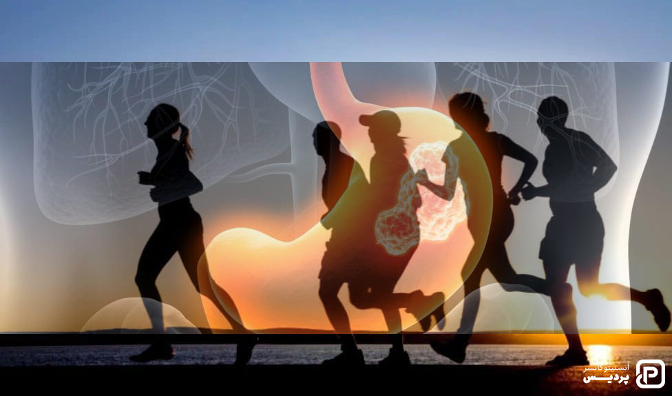 داشتن فعالیت بدنی جهت پیشگیری از سرطان معده