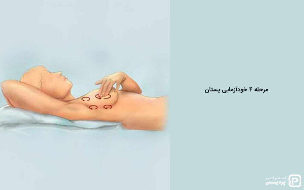مرحله 4 خودآزمایی پستان