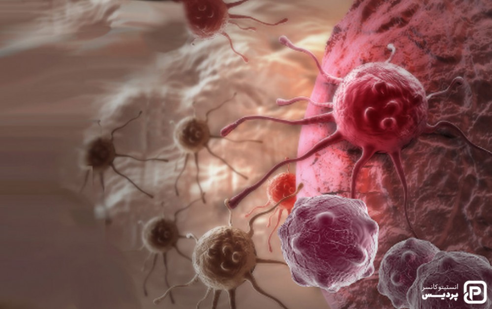 میکرومتاستازها