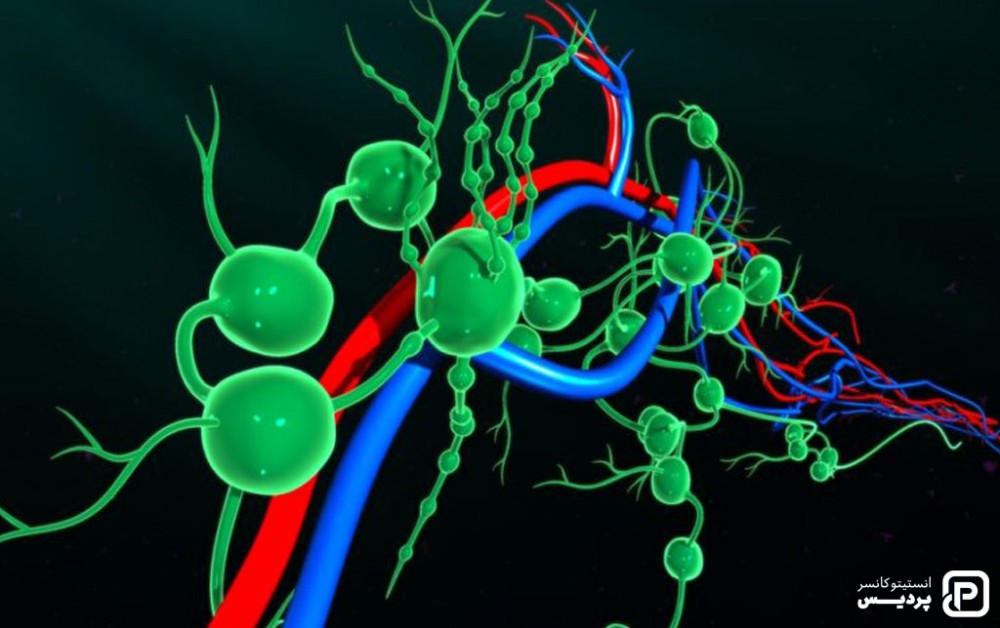 پخش شدن سرطان از طریق سیستم لنفاوی