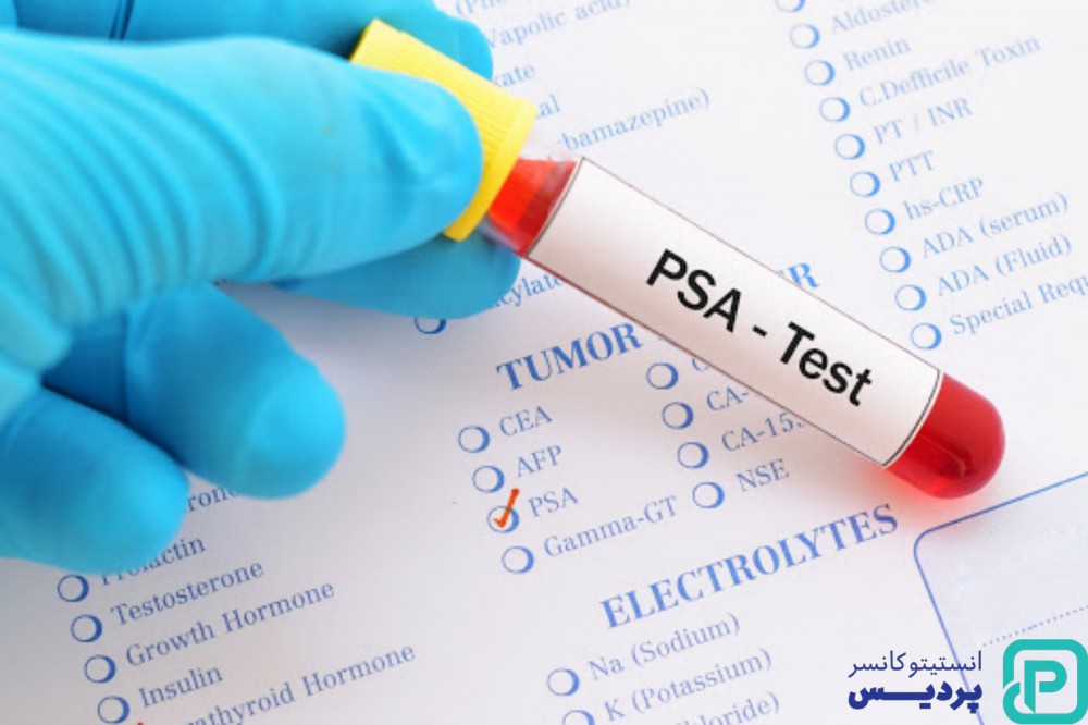 تشخیص به موقع سرطان پروستات