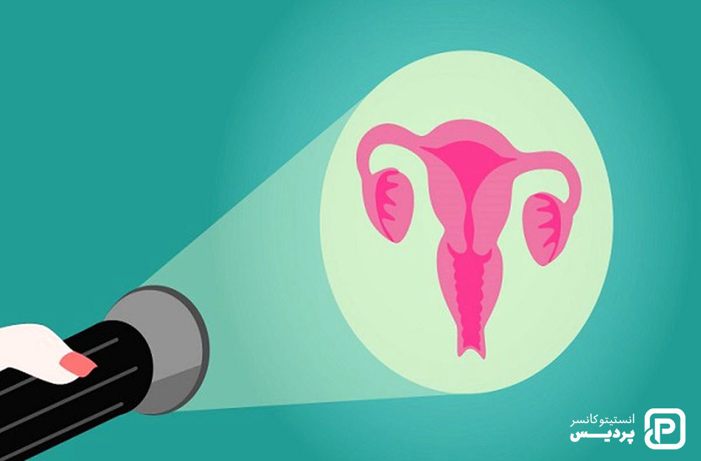 عوامل خطر سرطان دهانه رحم چه چیز هایی هستند