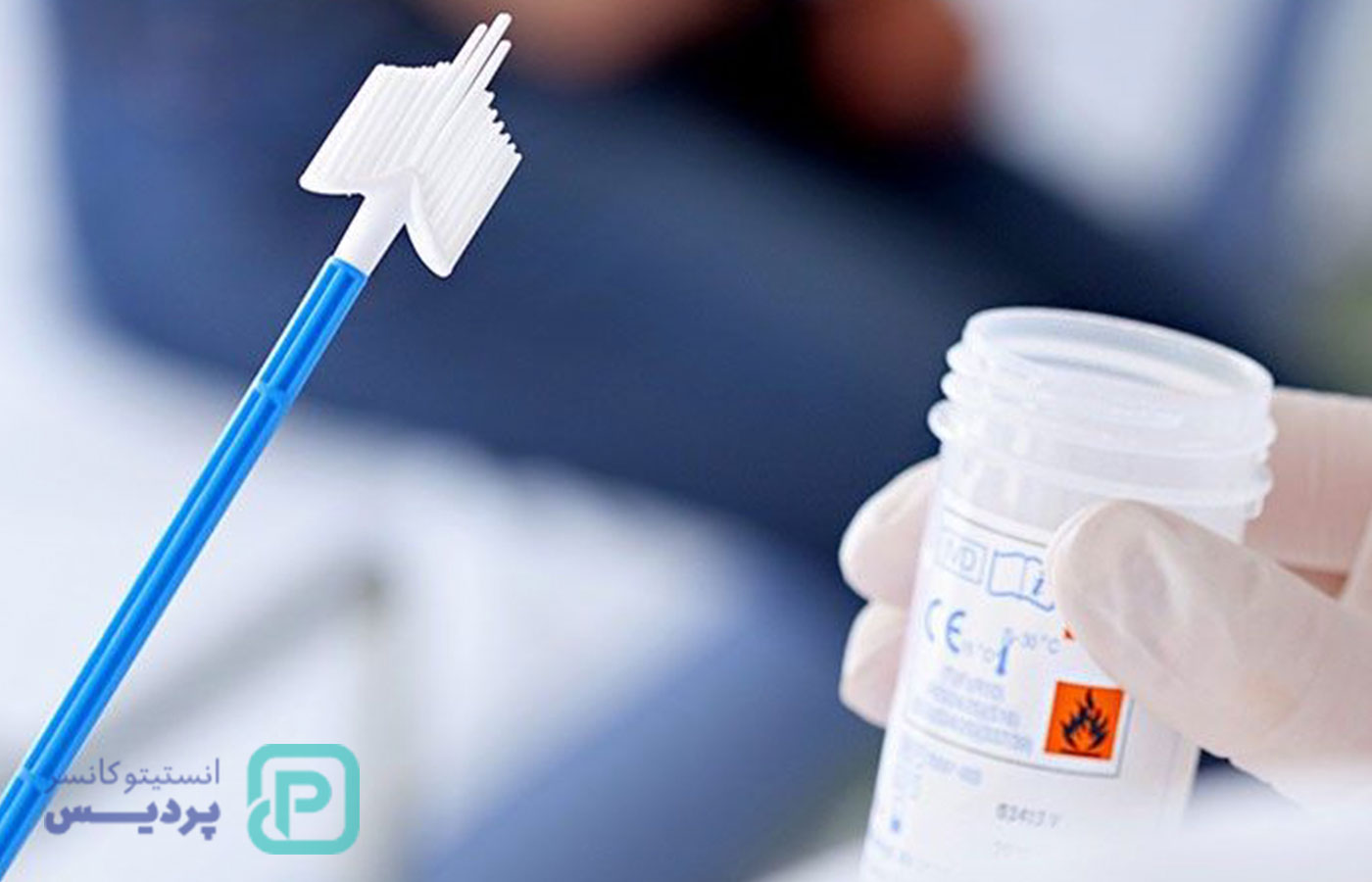 راهنمای جامع آزمایش HPV: از روش‌های تست تا تفسیر دقیق نتایج - 2