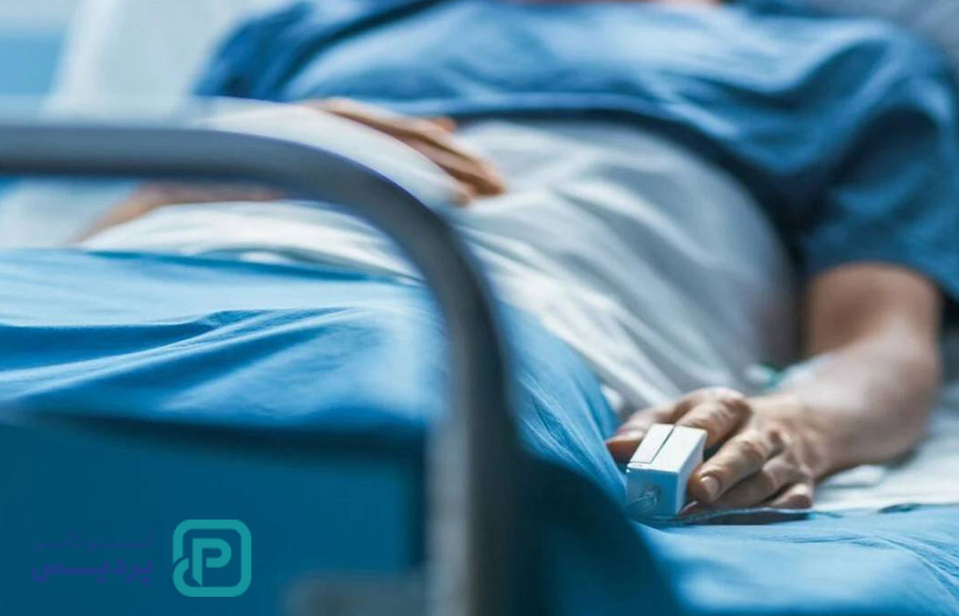 سرطان‌های شایع در ایران 1403؛ 5 موردی که باید بشناسید - 2