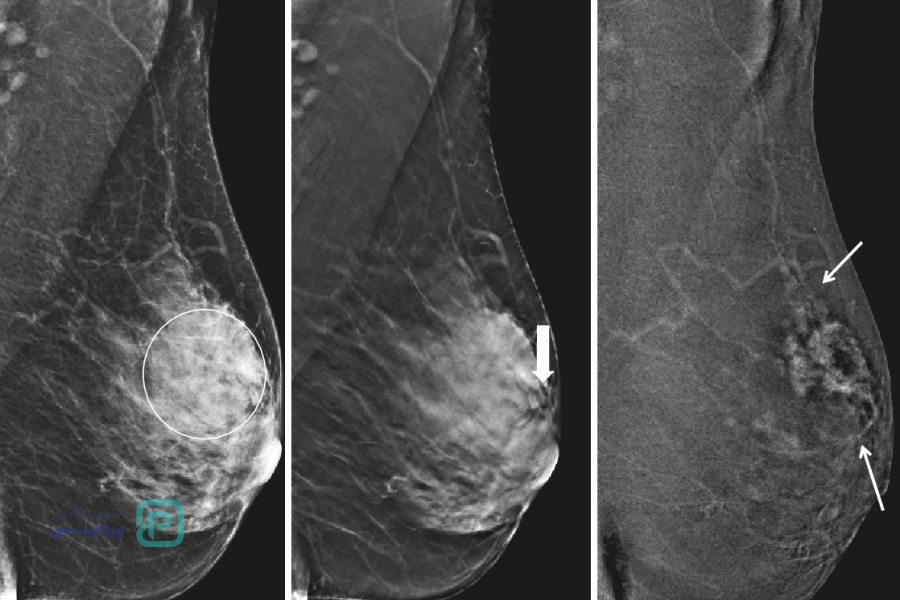 ماموگرافی در بهترین کلینیک شیراز
