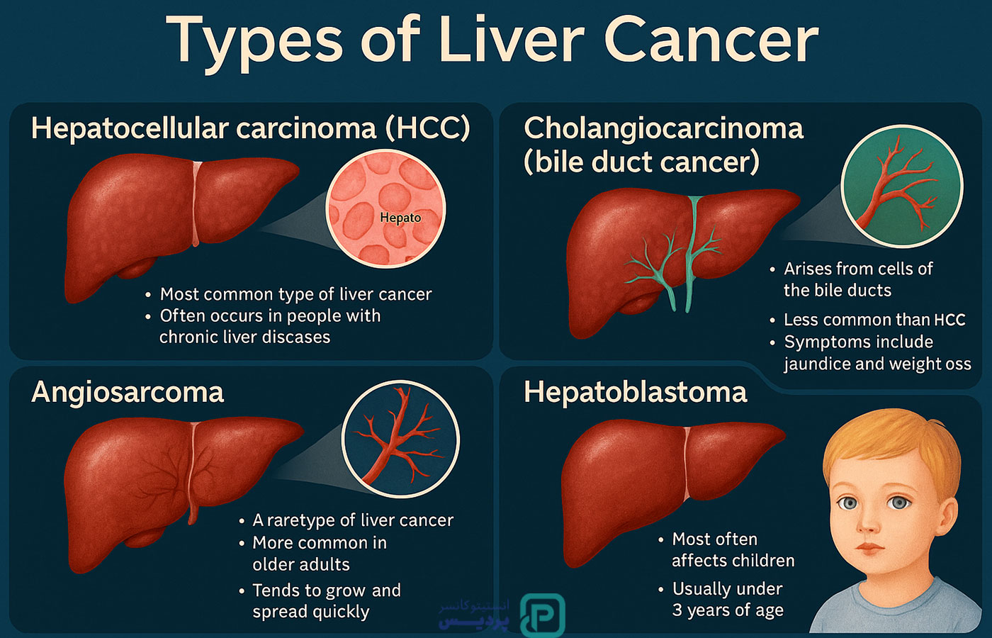 سرطان کبد؛ علائم، علل، روش‌های درمان و پیشگیری - 3