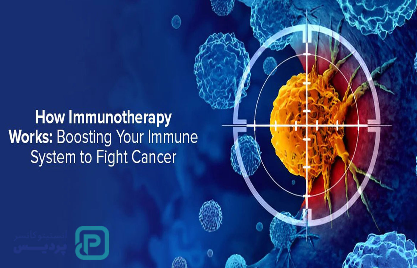 درمان سرطان ریه | معرفی روشهای موثر جراحی، دارویی و پرتودرمانی 5 درمان سرطان ریه | معرفی روشهای موثر جراحی، دارویی و پرتودرمانی - 5