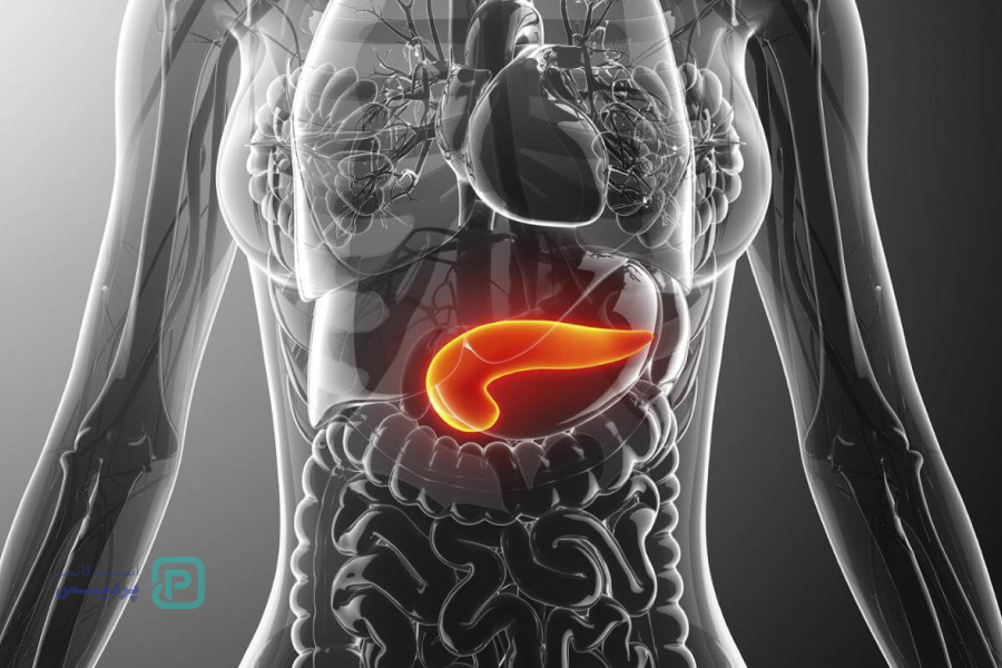 انواع سرطان: آشنایی با علائم، روشهای تشخیص و درمان 10 سرطان پانکراس