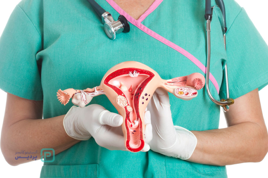 انواع سرطان: آشنایی با علائم، روشهای تشخیص و درمان 11 سرطان رحم