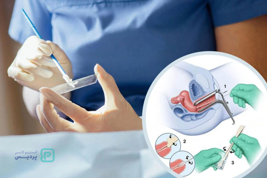 چه زمانی باید فوراً برای تست پاپ اسمیر اقدام کنید؟