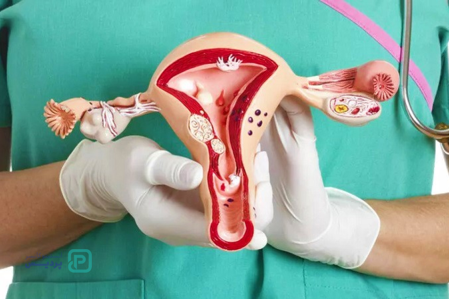 بهترین زمان تست پاپ اسمیر چه زمانی است؟ 6 متوقف کردن تست پاپ اسمیر: چه زمانی و برای چه کسانی؟