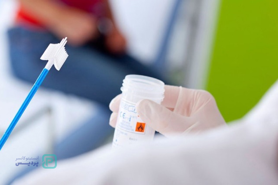 پاپ اسمیر چیست؟