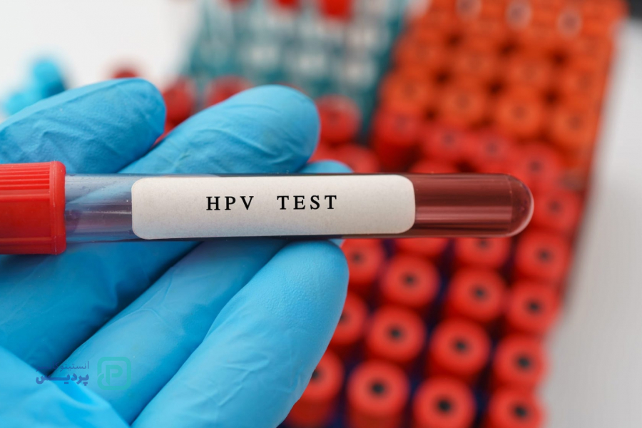 آزمایش hpv چیست؟