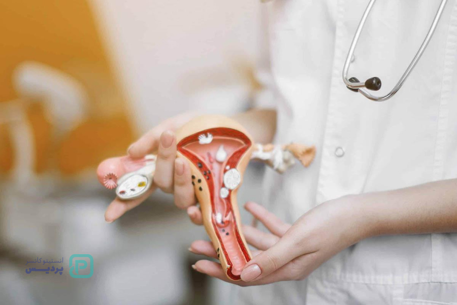 غربالگری سرطان دهانه رحم چیست؟ 0 تا 100 آزمایش غربالگری 7 چه کسانی به غربالگری سرطان دهانه رحم نیاز ندارند؟