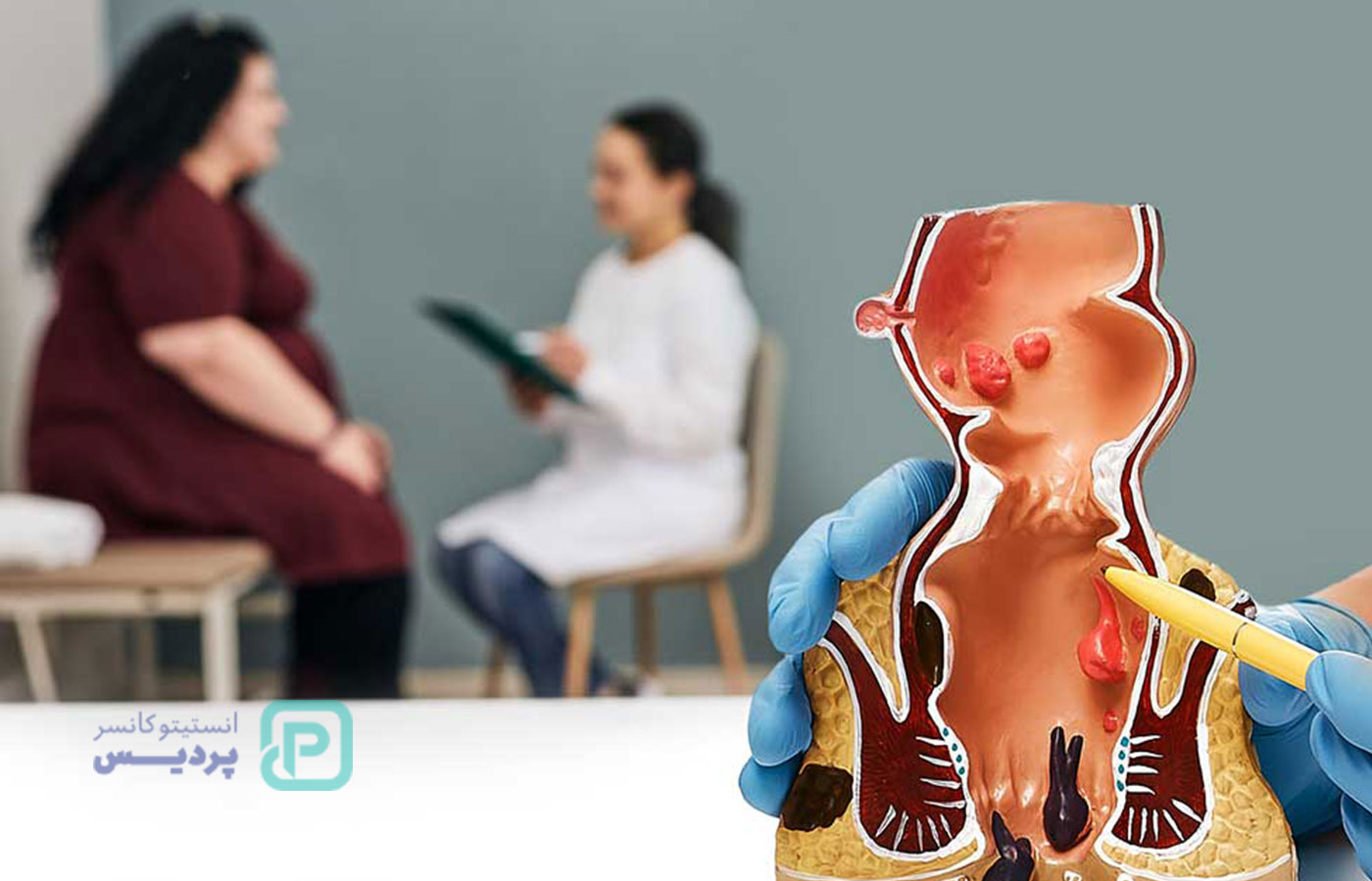 تفاوت بواسیر و سرطان مقعدی | چگونه تفاوت را تشخیص دهیم؟ 3 تفاوت بواسیر و سرطان مقعدی | چگونه تفاوت را تشخیص دهیم؟ - 3