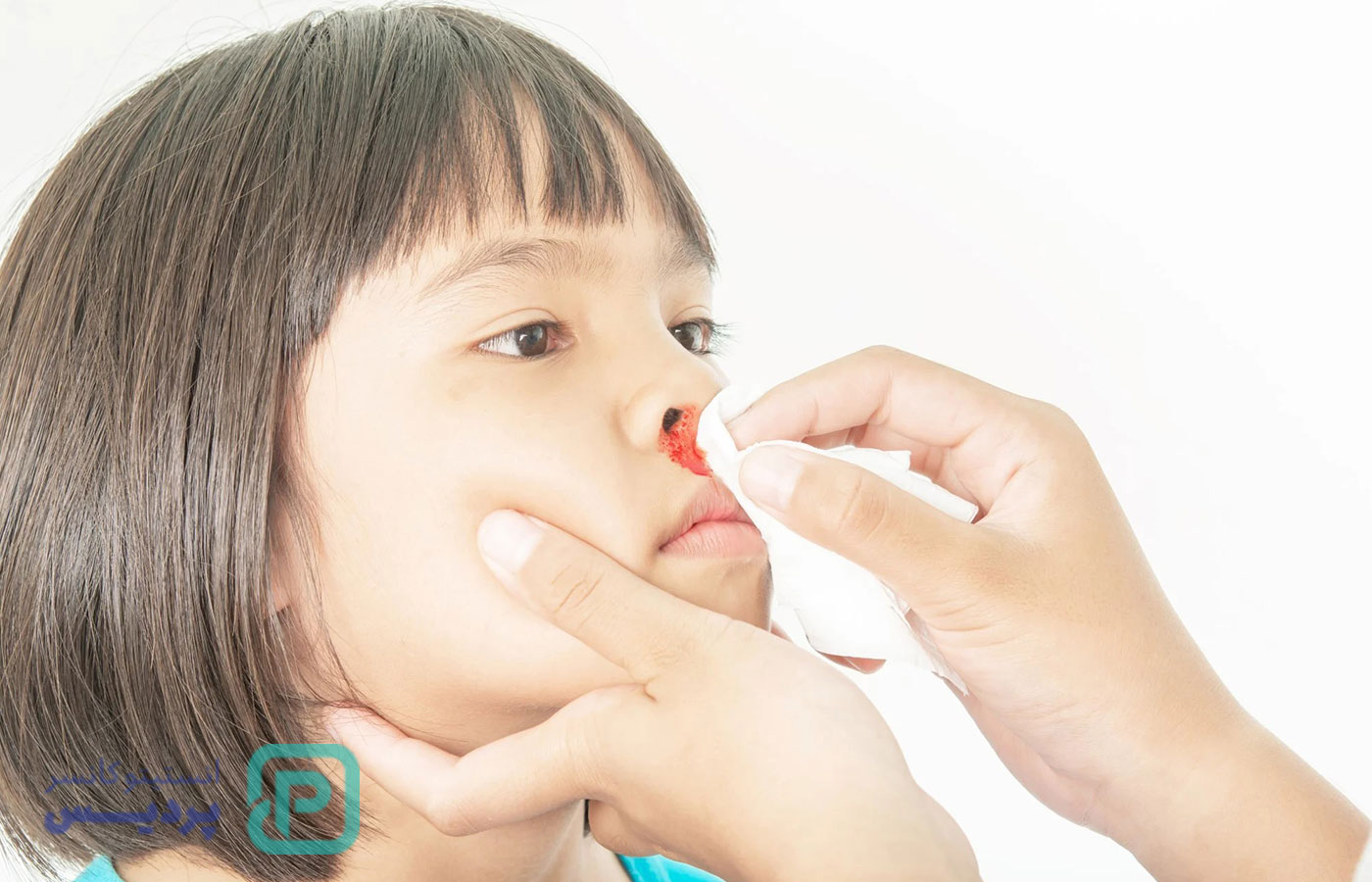 خون دماغ و سرطان | آیا خون دماغ شدن مکرر می‌تواند نشانه سرطان باشد؟ - 10