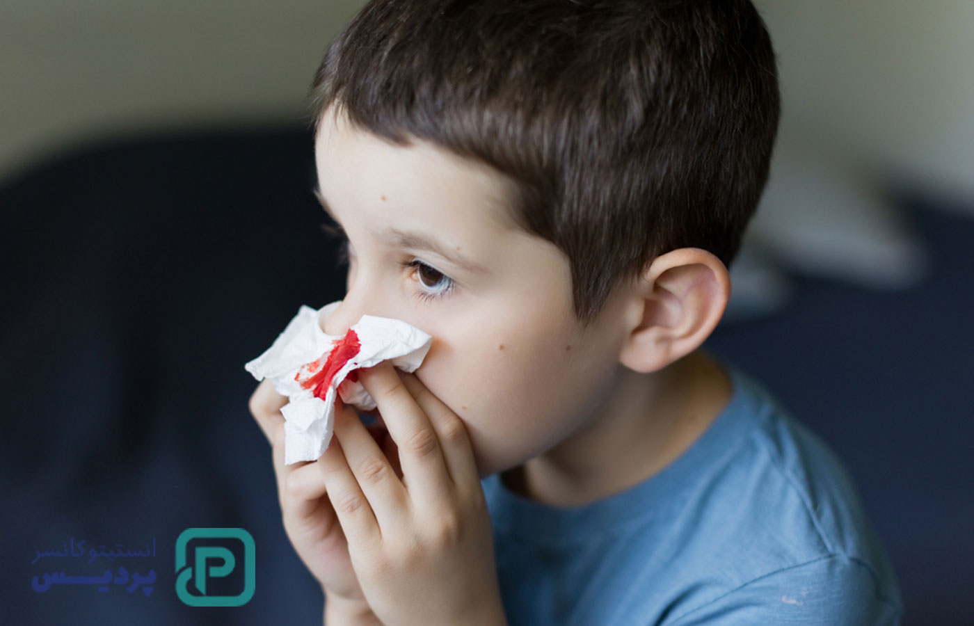 خون دماغ و سرطان | آیا خون دماغ شدن مکرر می‌تواند نشانه سرطان باشد؟ - 9