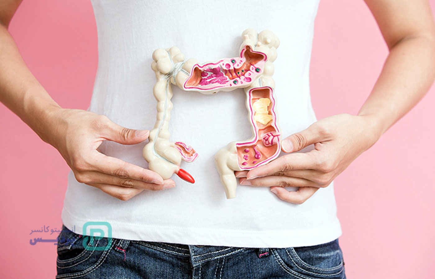 آیا خونریزی مقعدی میتواند نشانهای از سرطان روده باشد؟ 2 آیا خونریزی مقعدی میتواند نشانهای از سرطان روده باشد؟ - 2