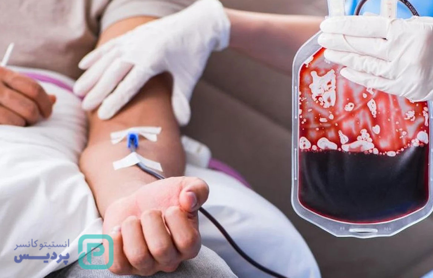 درمان فوری پلاکت خون پایین-1