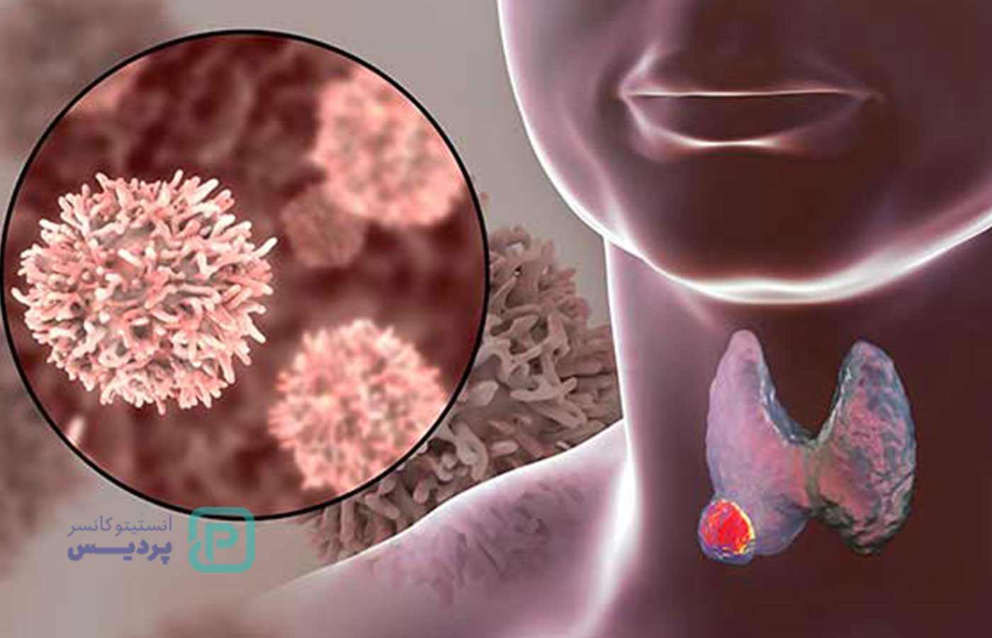 درمان‌های هدفمند سرطان یا تارگیت تراپی - 3
