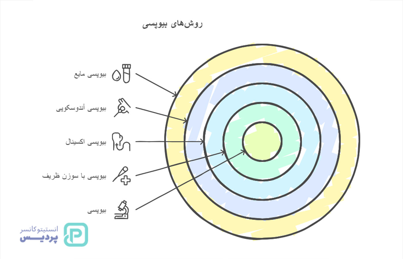 بیوپسی چیست؟ هرآنچه باید درباره نمونه‌برداری، روش‌ها و کاربردهای آن بدانید - 4