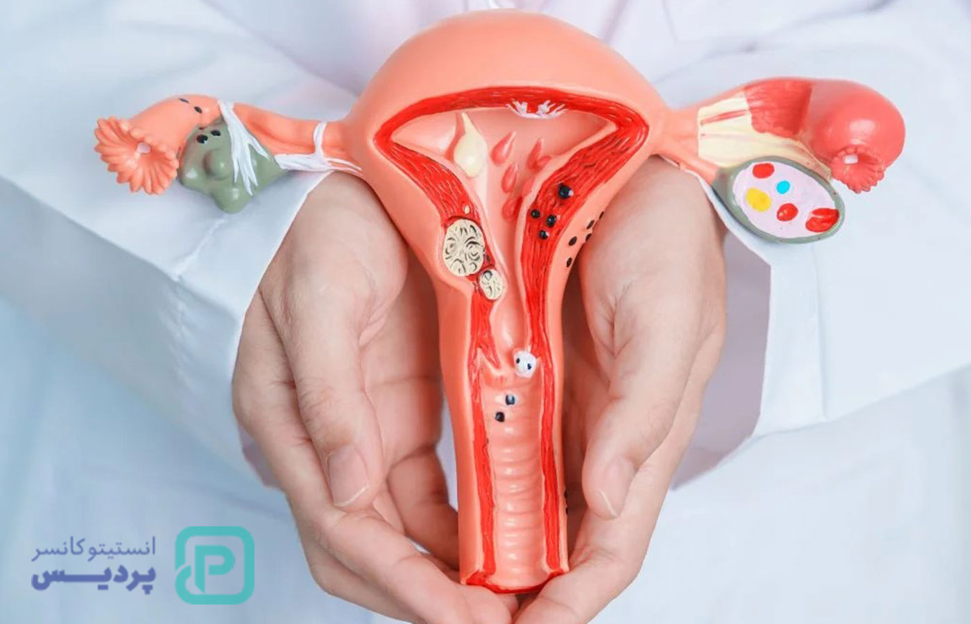 اولین علائم سرطان خون در زنان چیست؟ - 48