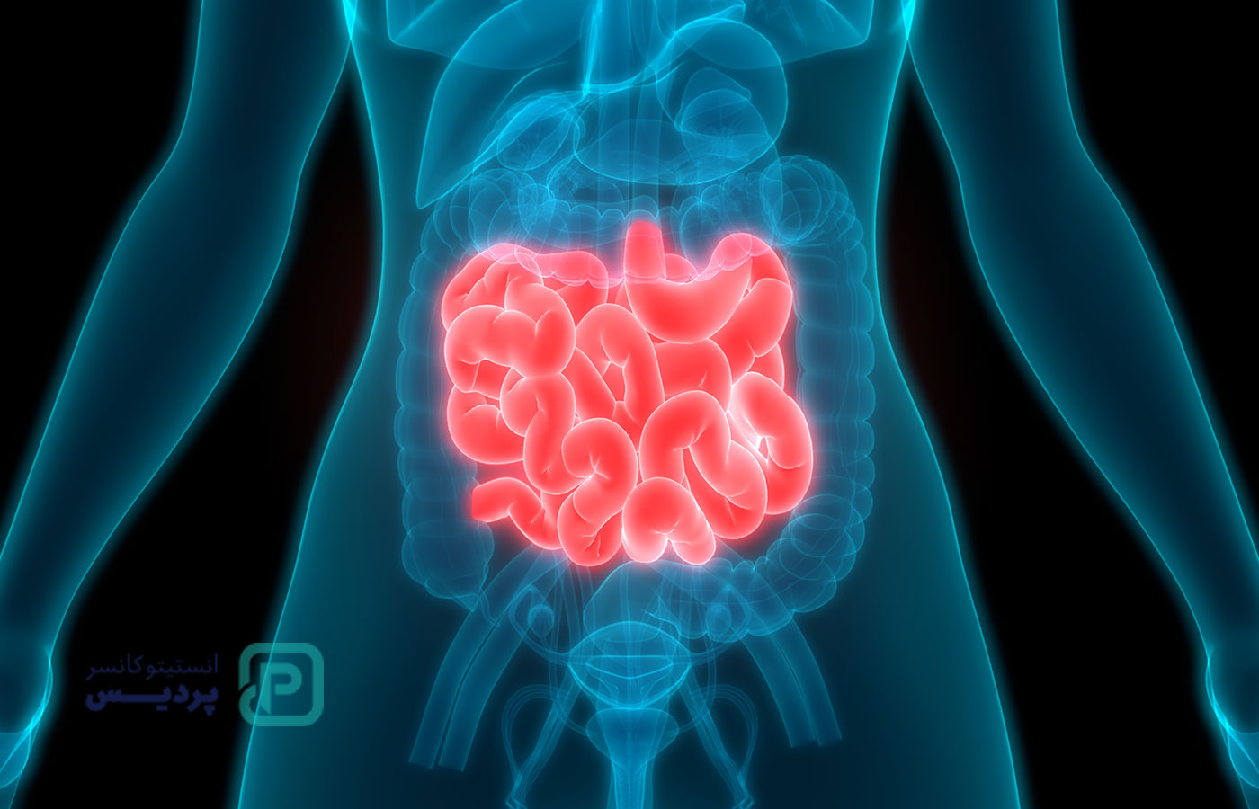 شایع‌ترین سرطان‌های دستگاه گوارش - 5