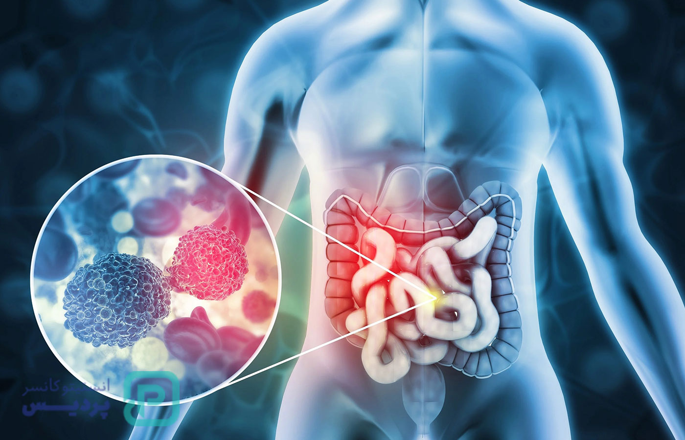 سرطانهای رایج در مردان بالای 40 سال و علائم هشداردهنده آنها 4 سرطانهای رایج در مردان بالای 40 سال و علائم هشداردهنده آنها - 4