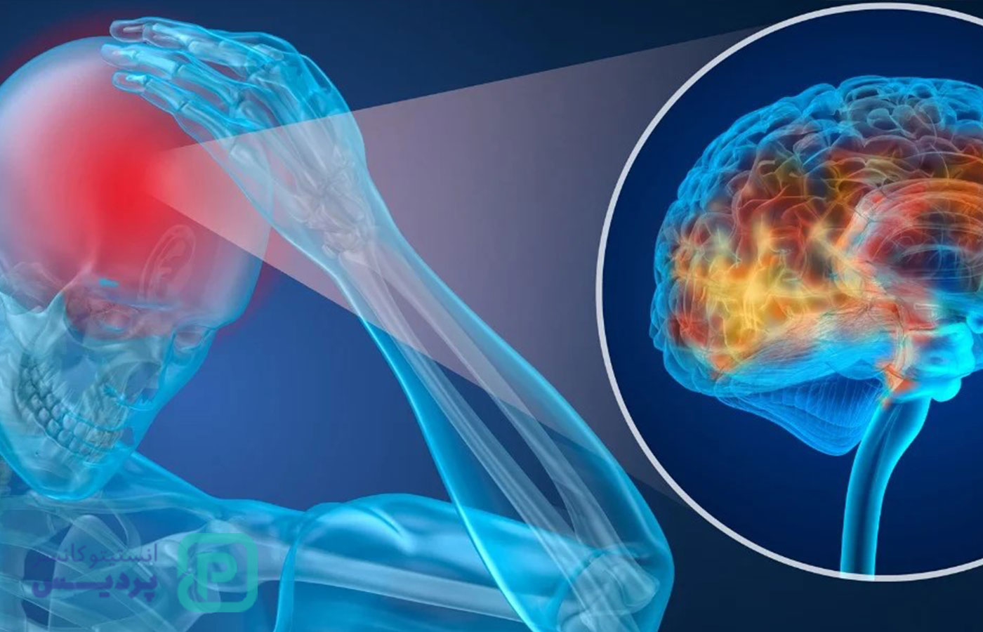 سرطان مغز استخوان چیست؟ علائم، انواع و روش‌های درمان مؤثر - 2