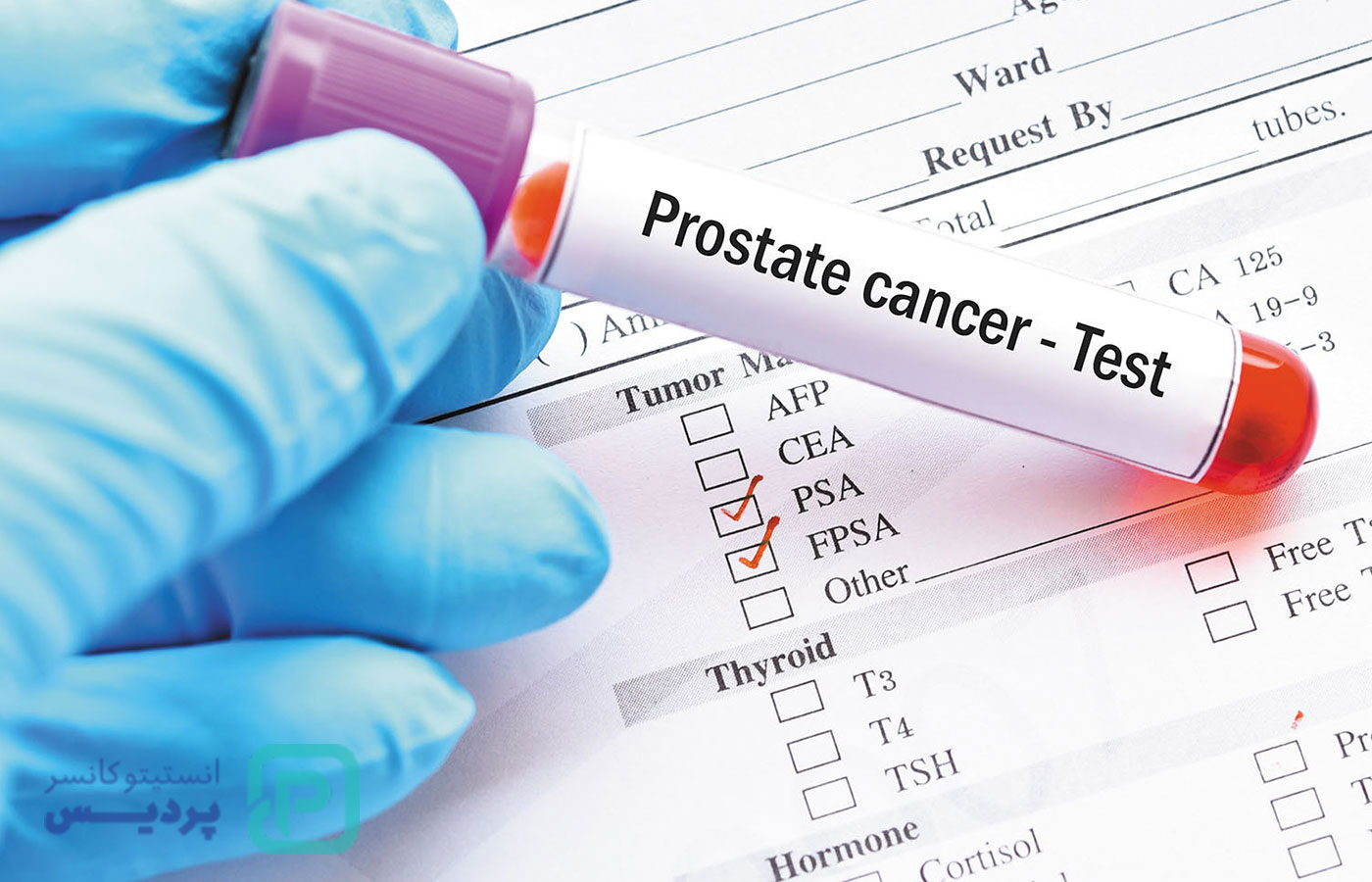 سرطانهای رایج در مردان بالای 40 سال و علائم هشداردهنده آنها 3 سرطانهای رایج در مردان بالای 40 سال و علائم هشداردهنده آنها - 3