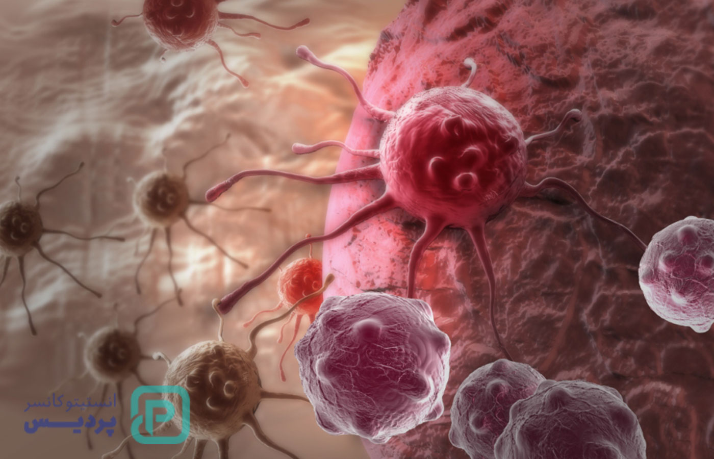 پیشرفته‌ترین مرکز درمان سرطان | معرفی امکانات و جدیدترین روش‌های درمانی - 20