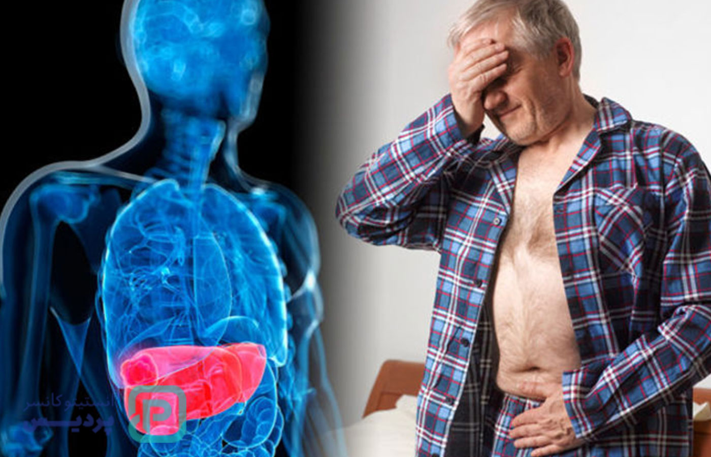 سرطانهای رایج در مردان بالای 40 سال و علائم هشداردهنده آنها 6 سرطانهای رایج در مردان بالای 40 سال و علائم هشداردهنده آنها - 6