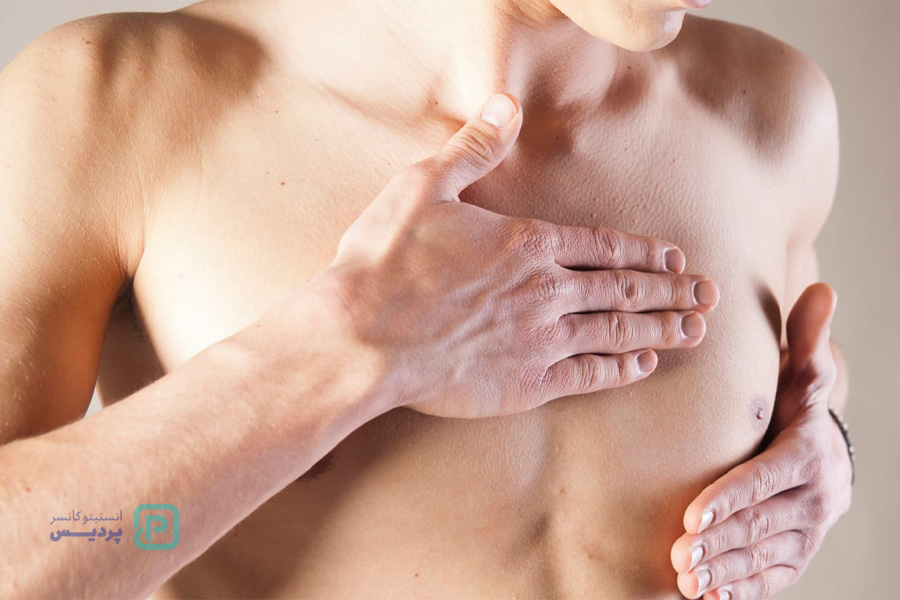 شناخت سرطان سینه در مردان 4 شناخت سرطان سینه در مردان